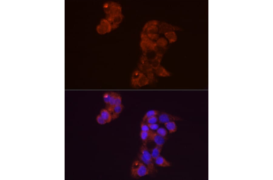 Immunofluorescence - Anti-FGF1 Antibody (A12678) - Antibodies.com