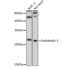 Western Blot - Anti-Endothelin 1 Antibody (A12679) - Antibodies.com