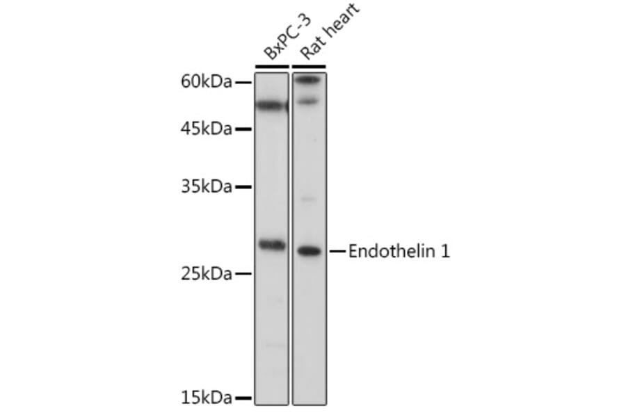 Western Blot - Anti-Endothelin 1 Antibody (A12679) - Antibodies.com