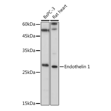 Western Blot - Anti-Endothelin 1 Antibody (A12679) - Antibodies.com