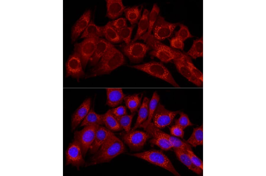 Immunofluorescence - Anti-Endothelin 1 Antibody (A12679) - Antibodies.com