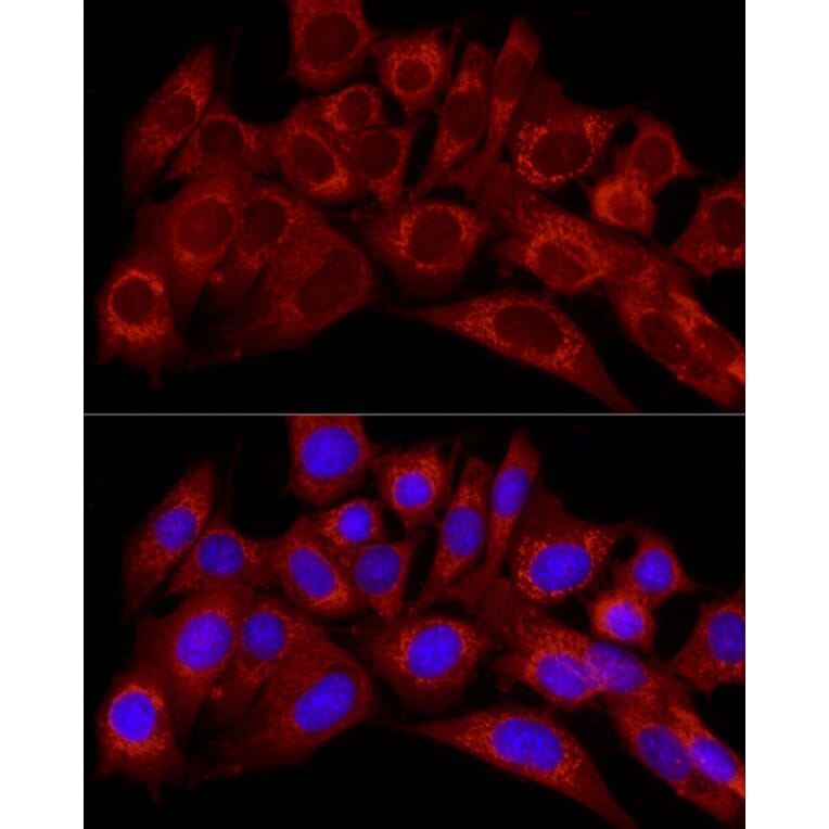 Immunofluorescence - Anti-Endothelin 1 Antibody (A12679) - Antibodies.com