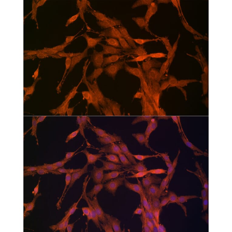 Immunofluorescence - Anti-NRG1 Antibody (A12680) - Antibodies.com