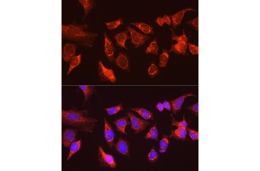 Immunofluorescence - Anti-KIAA0652/ATG13 Antibody (A12683) - Antibodies.com