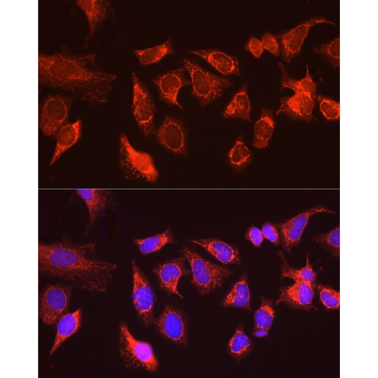 Immunofluorescence - Anti-KIAA0652/ATG13 Antibody (A12683) - Antibodies.com
