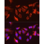 Immunofluorescence - Anti-KIAA0652/ATG13 Antibody (A12683) - Antibodies.com