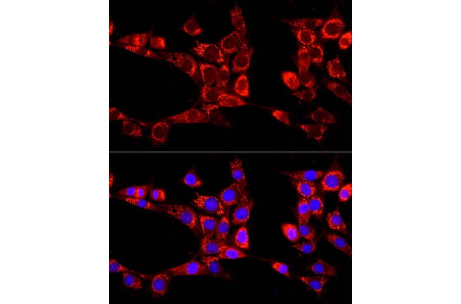 Immunofluorescence - Anti-KIAA0652/ATG13 Antibody (A12683) - Antibodies.com