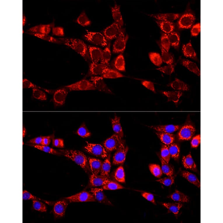 Immunofluorescence - Anti-KIAA0652/ATG13 Antibody (A12683) - Antibodies.com