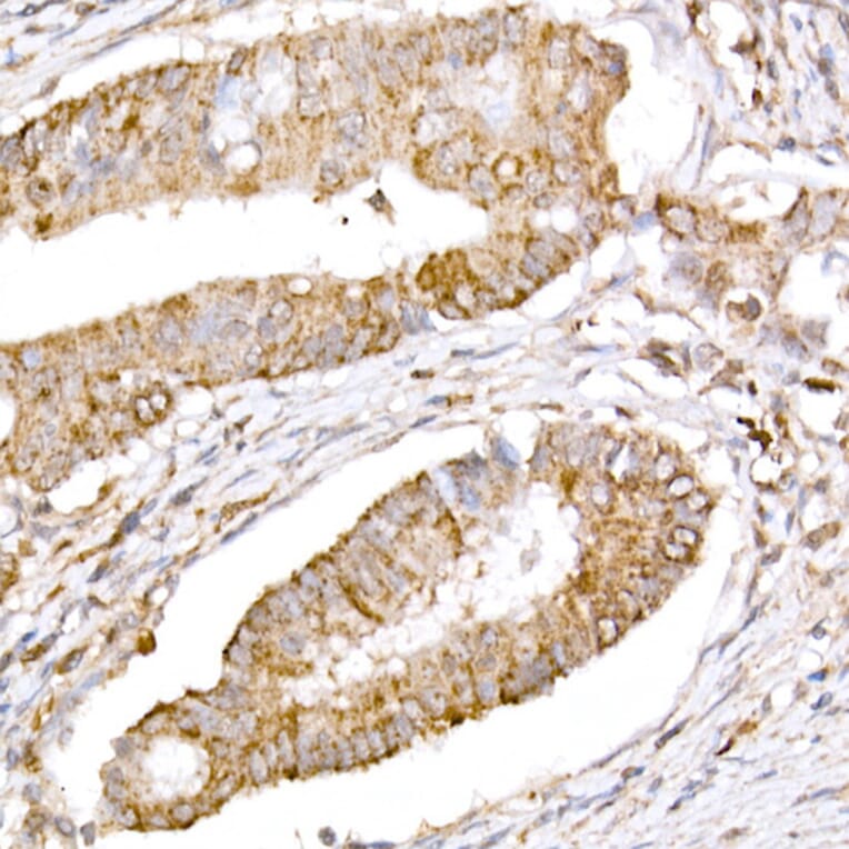 Immunohistochemistry - Anti-ATG7 Antibody (A12684) - Antibodies.com