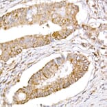 Immunohistochemistry - Anti-ATG7 Antibody (A12684) - Antibodies.com