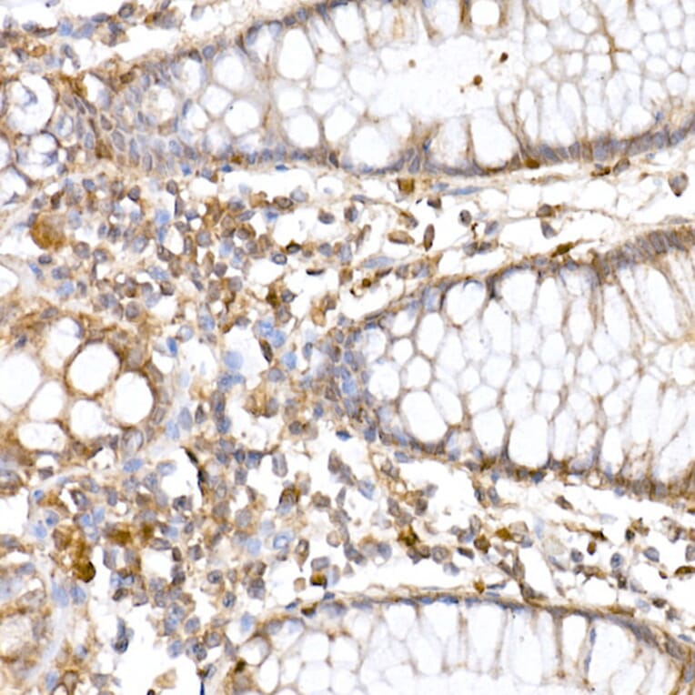 Immunohistochemistry - Anti-ATG7 Antibody (A12684) - Antibodies.com
