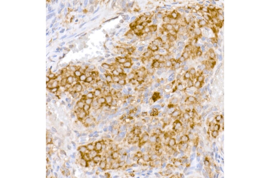 Immunohistochemistry - Anti-ATG7 Antibody (A12684) - Antibodies.com