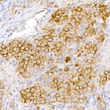Immunohistochemistry - Anti-ATG7 Antibody (A12684) - Antibodies.com