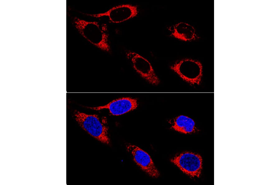 Immunofluorescence - Anti-P4HB Antibody (A12685) - Antibodies.com