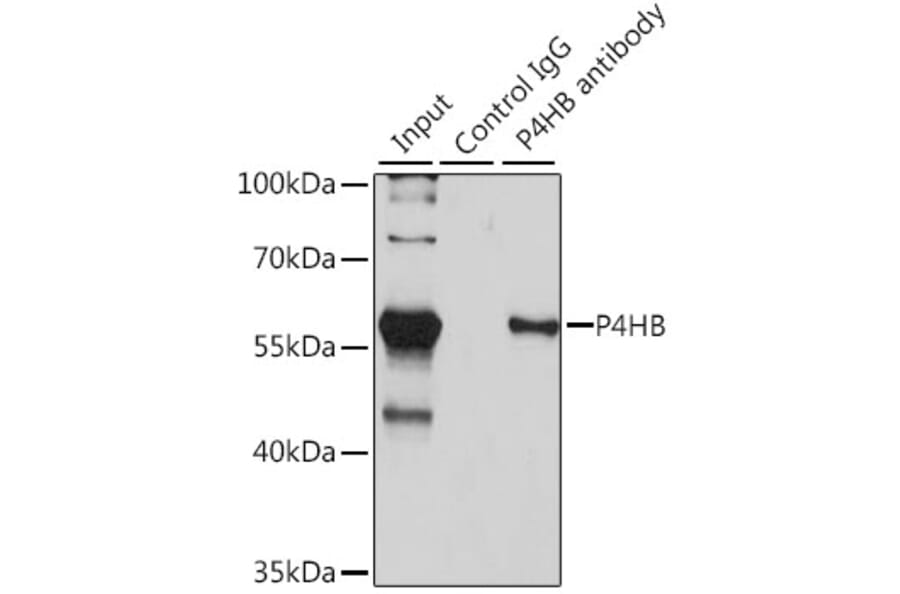 Immunoprecipitation - Anti-P4HB Antibody (A12685) - Antibodies.com