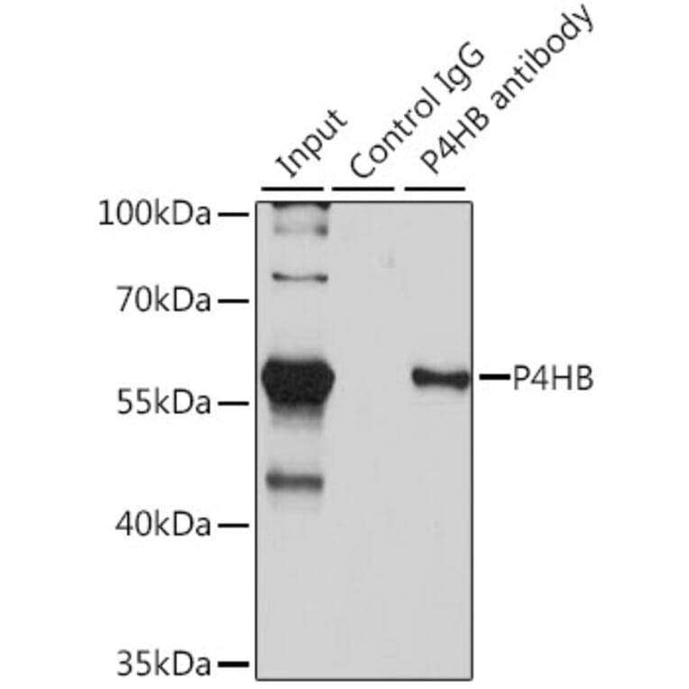 Immunoprecipitation - Anti-P4HB Antibody (A12685) - Antibodies.com