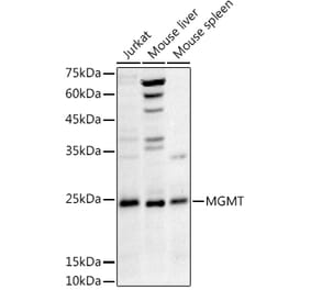 Western Blot - Anti-MGMT Antibody (A12686) - Antibodies.com