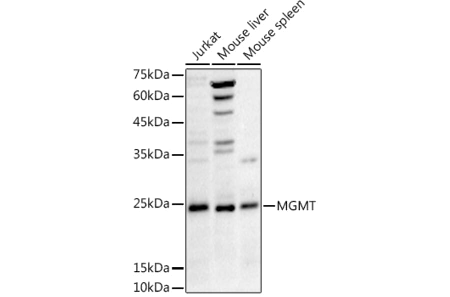 Western Blot - Anti-MGMT Antibody (A12686) - Antibodies.com