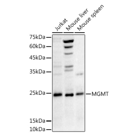 Western Blot - Anti-MGMT Antibody (A12686) - Antibodies.com