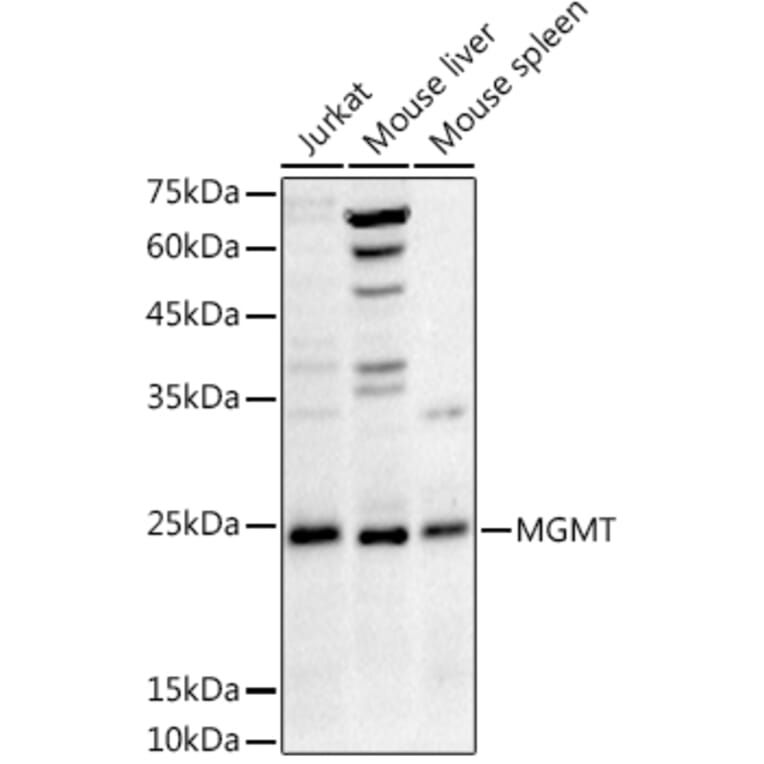 Western Blot - Anti-MGMT Antibody (A12686) - Antibodies.com