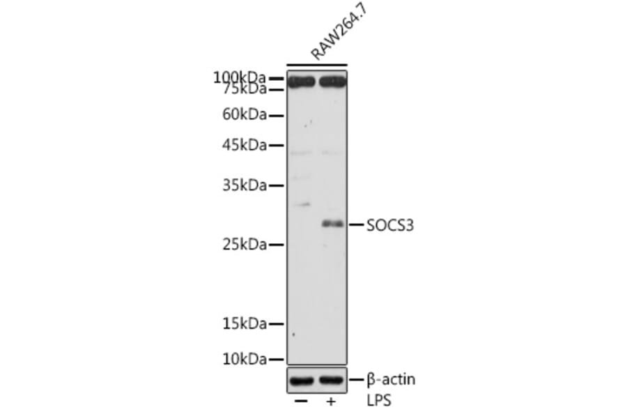 Western Blot - Anti-SOCS3 Antibody (A12687) - Antibodies.com