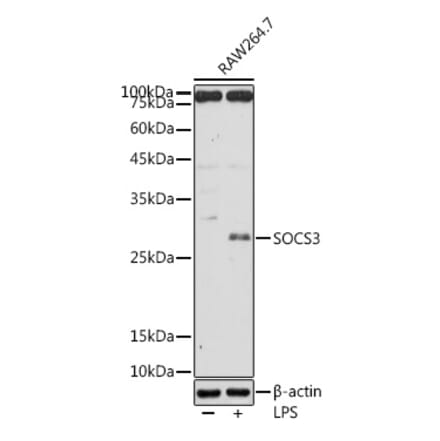 Western Blot - Anti-SOCS3 Antibody (A12687) - Antibodies.com