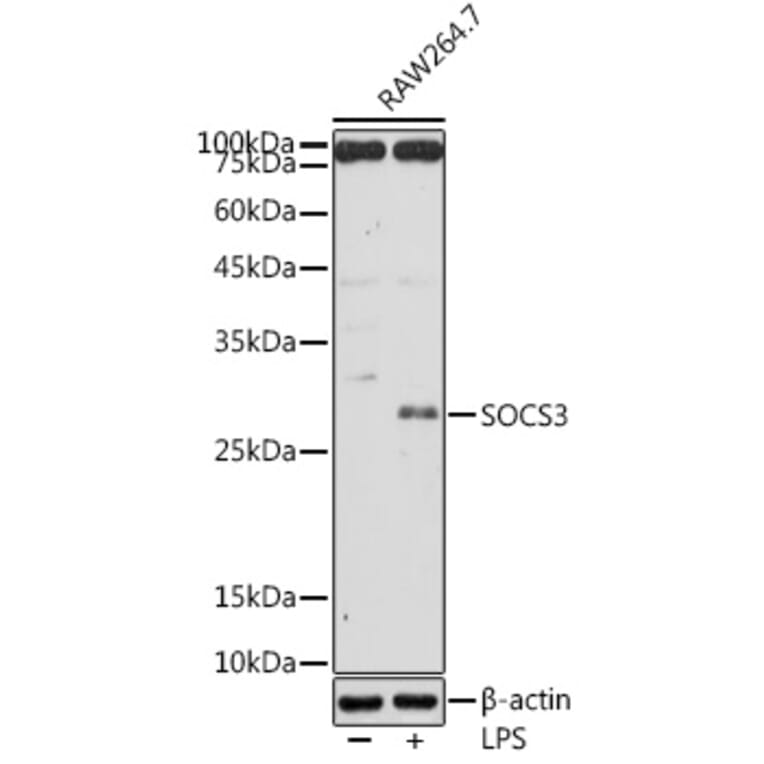 Western Blot - Anti-SOCS3 Antibody (A12687) - Antibodies.com