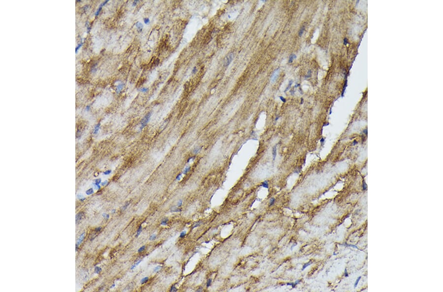 Immunohistochemistry - Anti-SOCS3 Antibody (A12687) - Antibodies.com