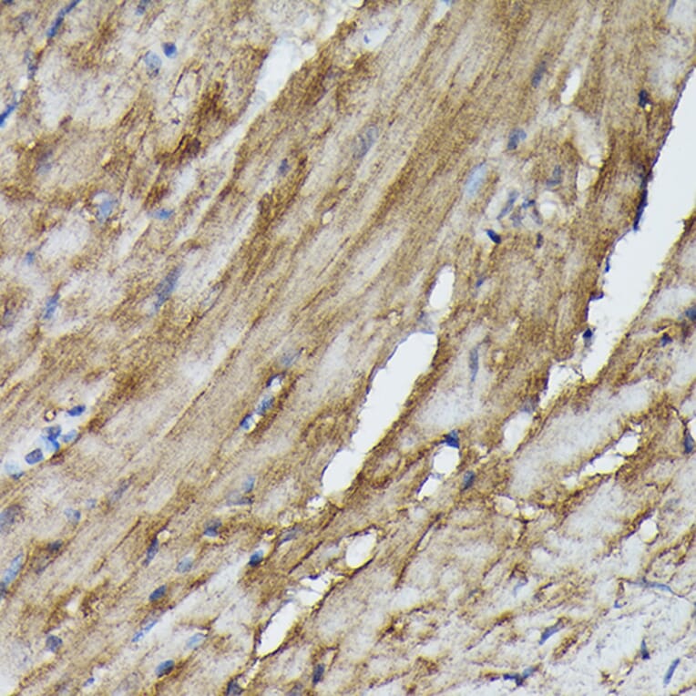 Immunohistochemistry - Anti-SOCS3 Antibody (A12687) - Antibodies.com