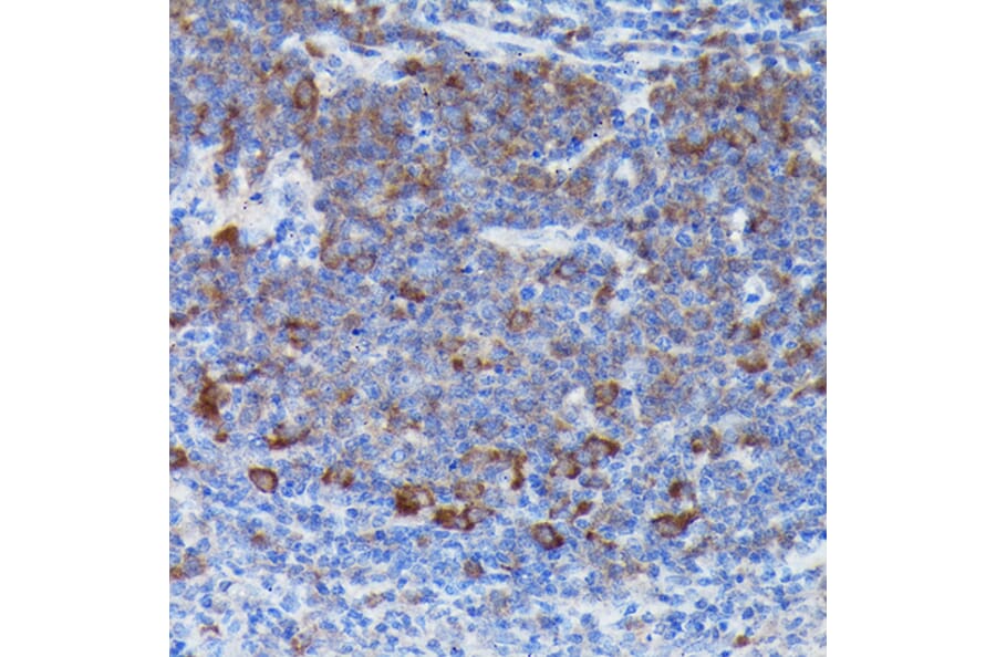 Immunohistochemistry - Anti-SOCS3 Antibody (A12687) - Antibodies.com