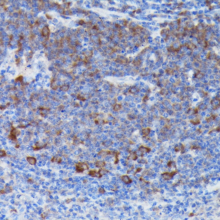 Immunohistochemistry - Anti-SOCS3 Antibody (A12687) - Antibodies.com