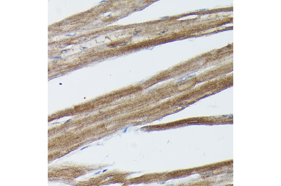 Immunohistochemistry - Anti-SOCS3 Antibody (A12687) - Antibodies.com