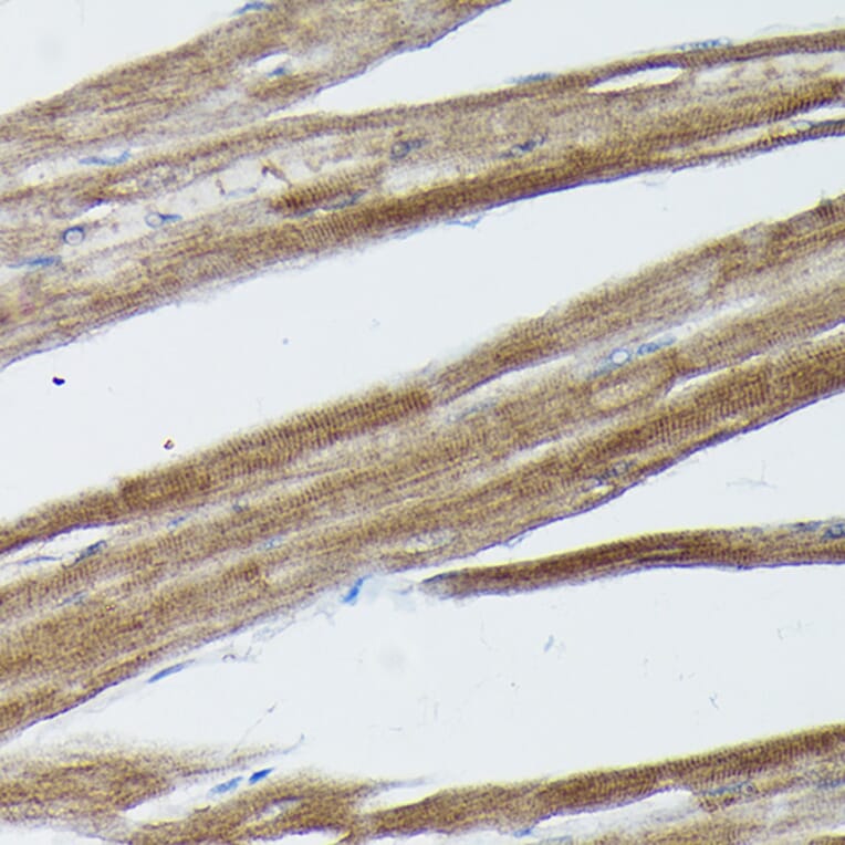 Immunohistochemistry - Anti-SOCS3 Antibody (A12687) - Antibodies.com