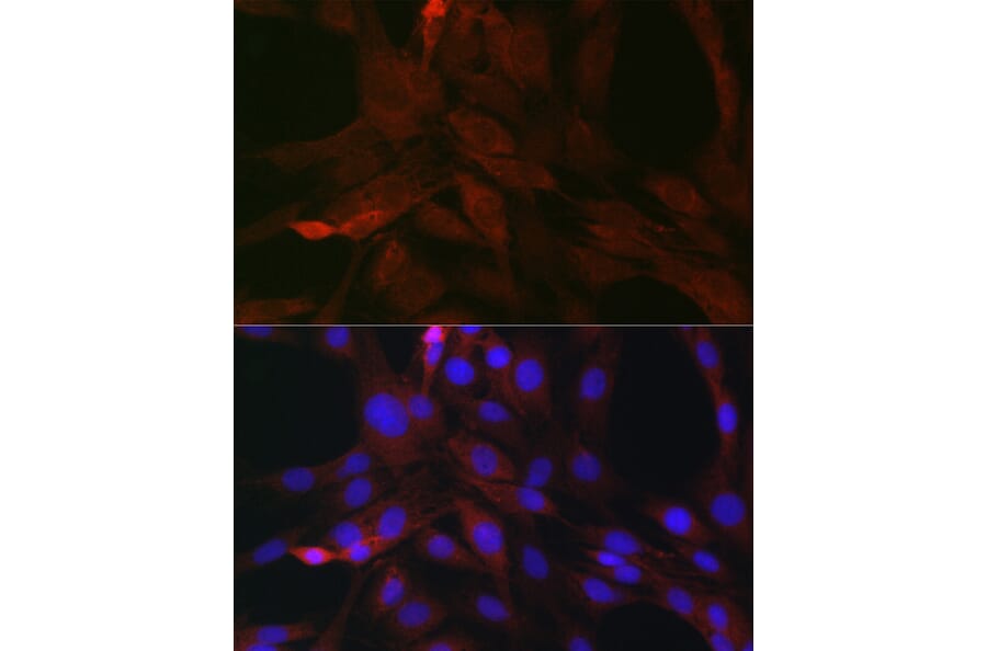 Immunofluorescence - Anti-SOCS3 Antibody (A12687) - Antibodies.com
