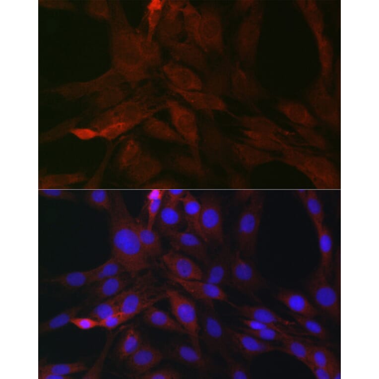 Immunofluorescence - Anti-SOCS3 Antibody (A12687) - Antibodies.com