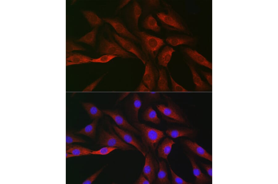 Immunofluorescence - Anti-SOCS3 Antibody (A12687) - Antibodies.com