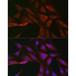 Immunofluorescence - Anti-SOCS3 Antibody (A12687) - Antibodies.com