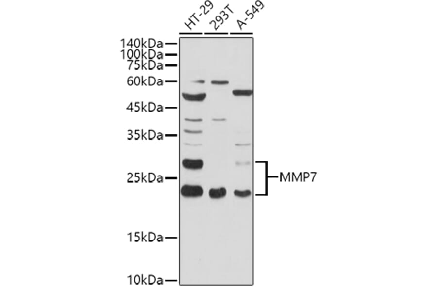 Western Blot - Anti-MMP7 Antibody (A12688) - Antibodies.com
