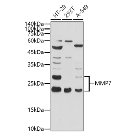 Western Blot - Anti-MMP7 Antibody (A12688) - Antibodies.com