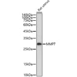 Western Blot - Anti-MMP7 Antibody (A12688) - Antibodies.com