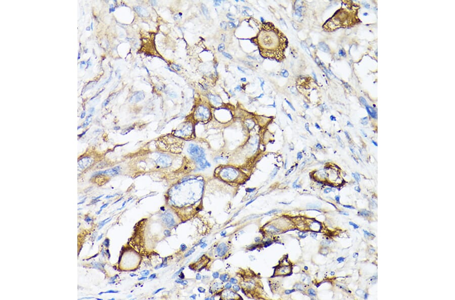 Immunohistochemistry - Anti-MMP7 Antibody (A12688) - Antibodies.com