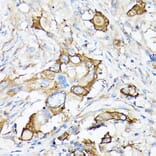 Immunohistochemistry - Anti-MMP7 Antibody (A12688) - Antibodies.com