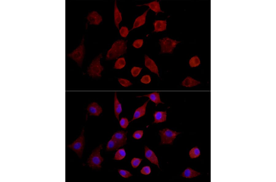 Immunofluorescence - Anti-MMP7 Antibody (A12688) - Antibodies.com