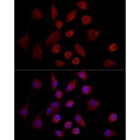 Immunofluorescence - Anti-MMP7 Antibody (A12688) - Antibodies.com
