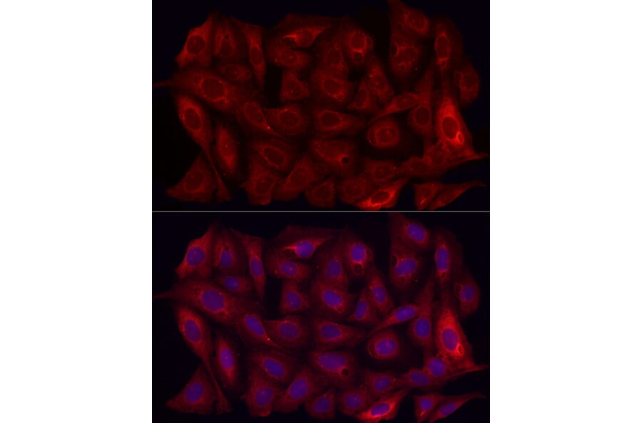 Immunofluorescence - Anti-MMP7 Antibody (A12688) - Antibodies.com