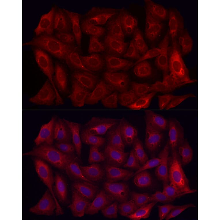 Immunofluorescence - Anti-MMP7 Antibody (A12688) - Antibodies.com