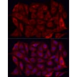 Immunofluorescence - Anti-MMP7 Antibody (A12688) - Antibodies.com