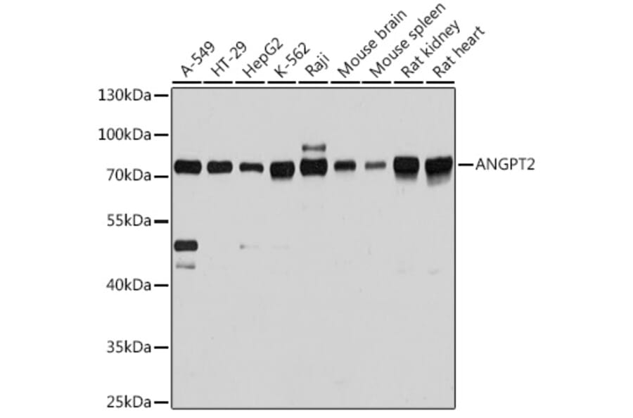 Western Blot - Anti-Angiopoietin 2/ANG2 Antibody (A12691) - Antibodies.com