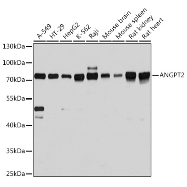 Western Blot - Anti-Angiopoietin 2/ANG2 Antibody (A12691) - Antibodies.com
