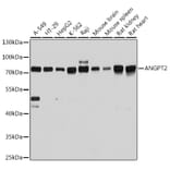Western Blot - Anti-Angiopoietin 2/ANG2 Antibody (A12691) - Antibodies.com